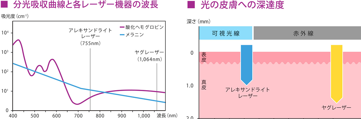 パワーアップしたレーザー出力で高い効果を実現
